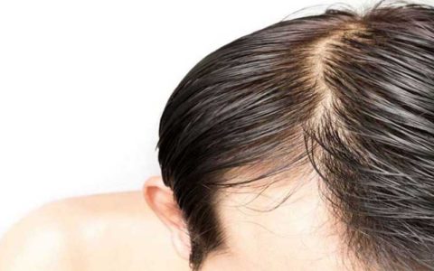 علت چربی مو سر چیست